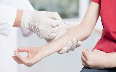 تست پریک چیست؟