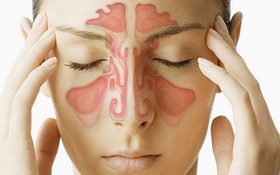 سینوزیت را بهتر بشناسیم