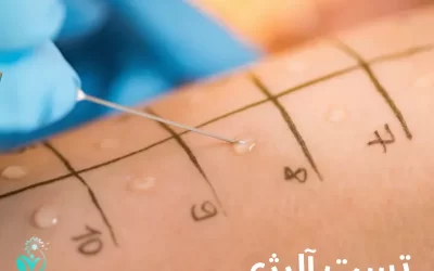 تست آلرژی یا آزمایش حساسیت چیست؟