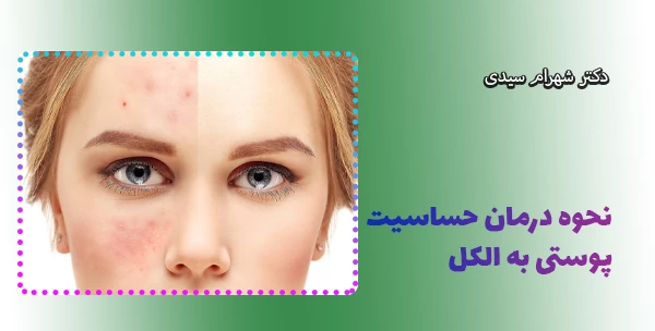 نحوه درمان حساسیت پوستی به الکل