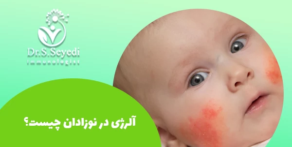 آلرژی در نوزادان چیست