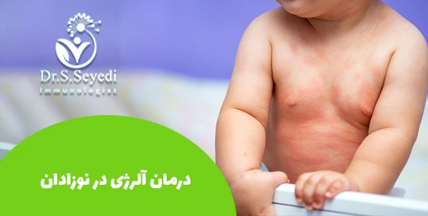 درمان آلرژی در نوزادان