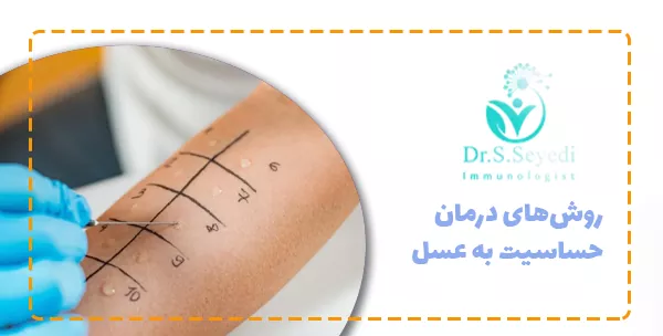 روش‌های درمان حساسیت به عسل