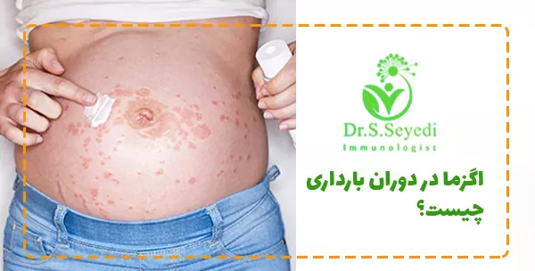 اگزما در دوران بارداری چیست؟