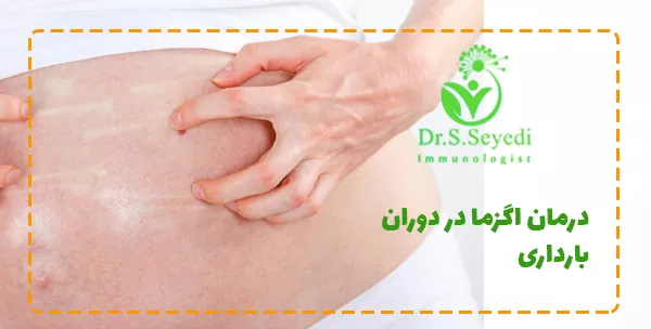 درمان اگزما در دوران بارداری