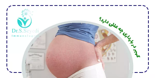 کهیر در بارداری چه عللی دارد؟