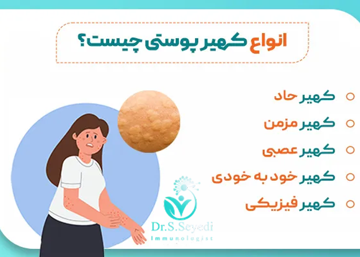 انواع کهیر
